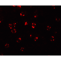 Polyclonal Rabbit anti-Human BCL2L11 / BIM Antibody (IHC, IF, WB)