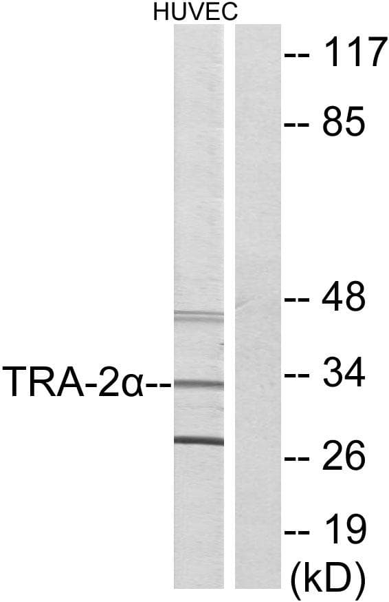 Polyclonal Rabbit anti-Human TRA2A Antibody (IHC, IF, WB)