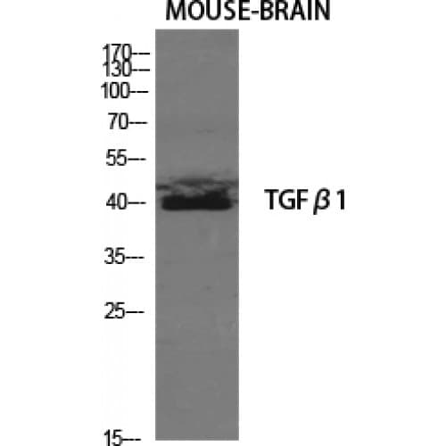 IHC-plus™ TGFB1 / TGF Beta 1 Antibody (310-390 aa, C-terminal)