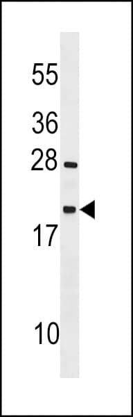 Polyclonal Rabbit anti-Human TEX12 Antibody (aa34-63, WB)