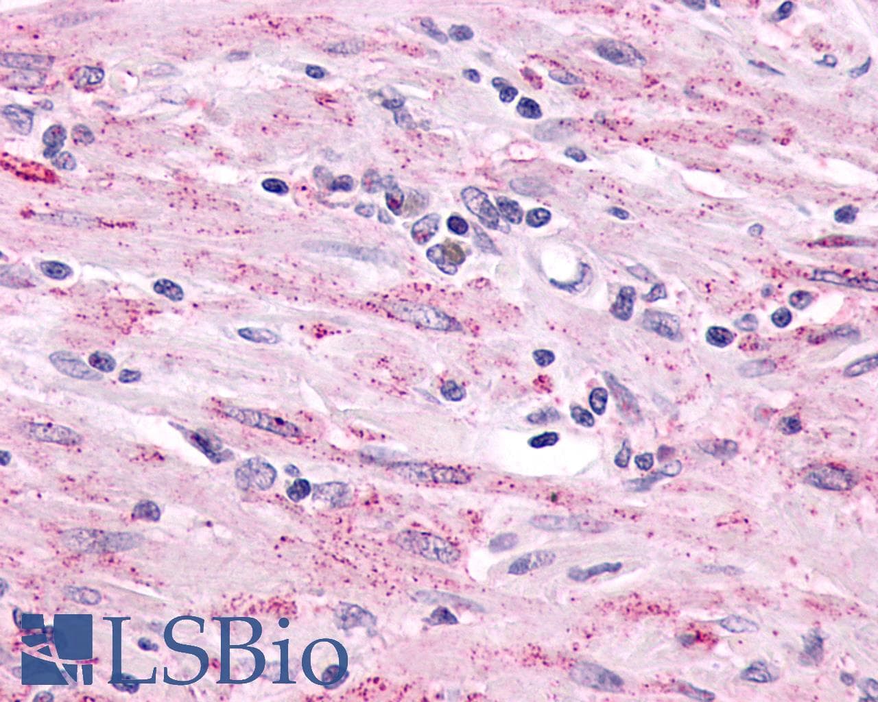 IHC-plus™ ADGRL2 / LPHN2 Antibody (N-Terminus)