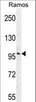 Polyclonal Rabbit anti-Human GUCY2D Antibody (aa540-570, IHC, WB)
