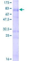 Human HTR2B / 5-HT2B Receptor Protein (Recombinant GST)