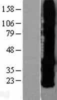 Human GJB2 / CX26 / Connexin 26 Protein (Over-Expression Lysate Myc-DDK (Flag))