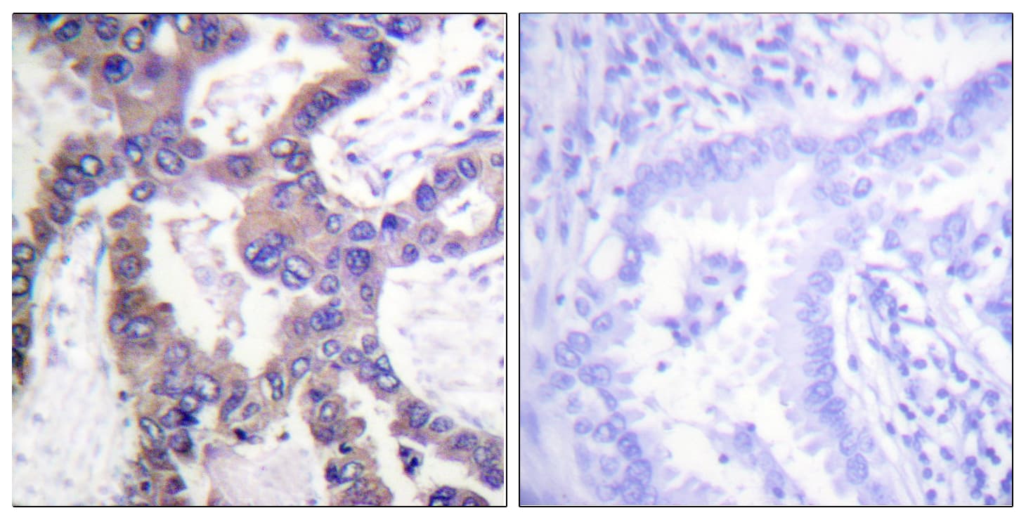 DUSP1 / MKP1 Antibody (phospho-Ser359)