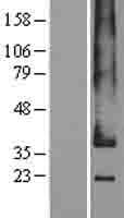 GPR182 / ADMR Protein (Over-Expression Lysate Myc-DDK (Flag))