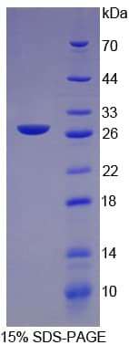 Rat CRP / C-Reactive Protein (Recombinant His-T7)