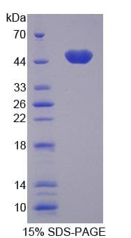 Human LMNA / Lamin A+C Protein (Recombinant His-T7)