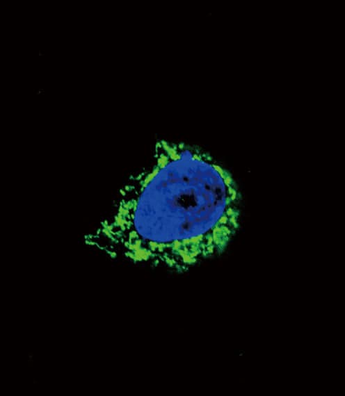 IHC-plus™ IGFBP2 / IGF-BP53 Antibody (aa277-305)