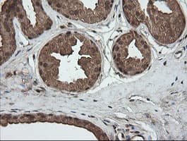 CRYAA / Alpha A Crystallin Antibody (clone OTI3B12, Carrier-free)