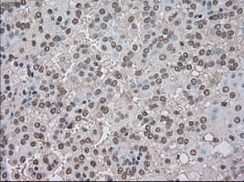 Monoclonal Mouse anti-Human BUB1B / BubR1 Antibody (clone OTI10B7, IHC, IF, WB)