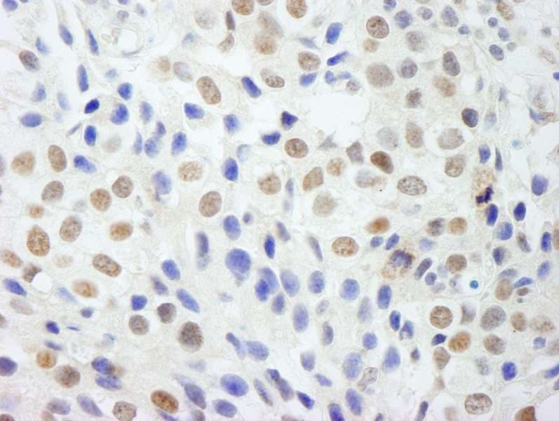 DP97 / DDX54 Antibody (aa625-675)