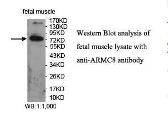 ARMC8 Antibody (aa10-178)