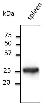 PathPlus™ RAB5A / RAB5 Antibody (C-Terminus)