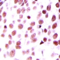 MDM2 Antibody (Internal)