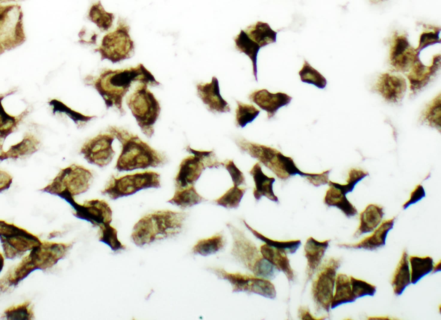 PDK2 Antibody (aa379-392)