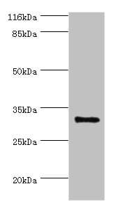 KLK5 / Kallikrein 5 Antibody (aa23-293)