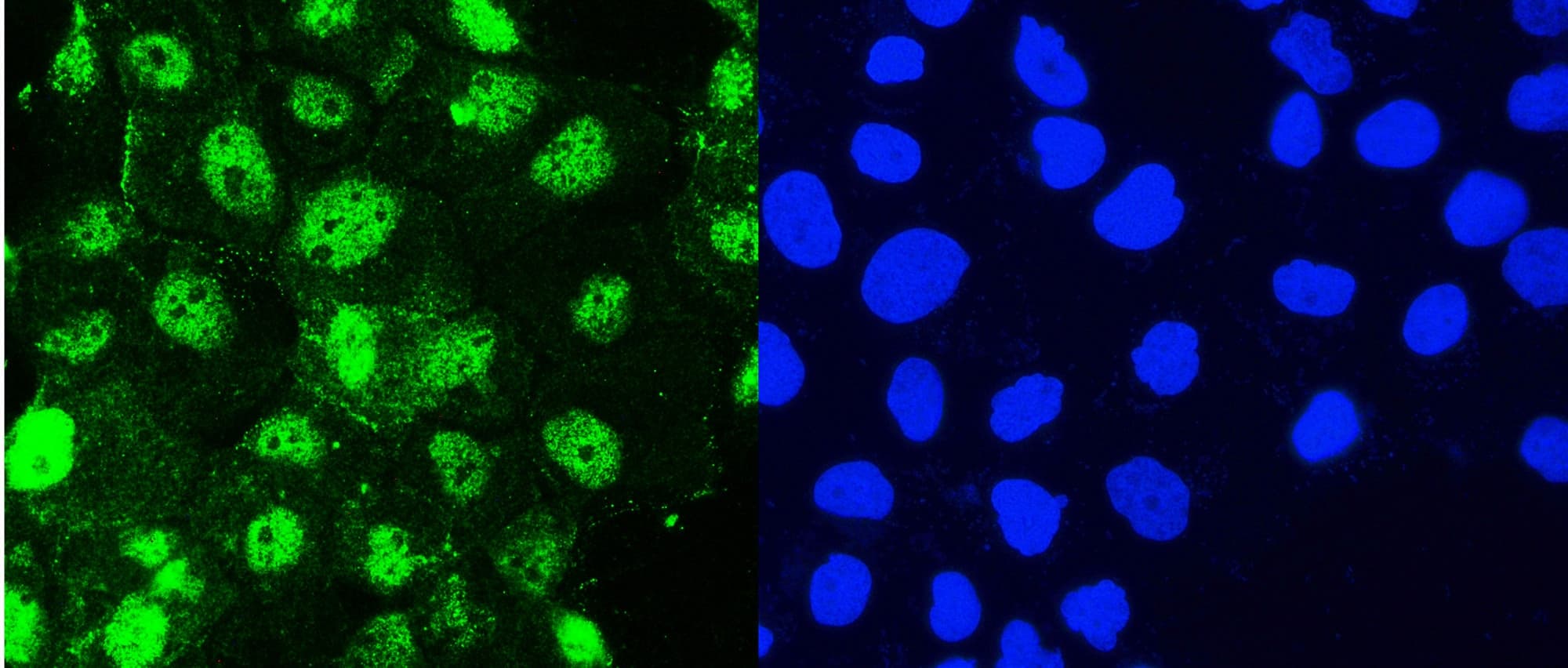 Polyclonal Rabbit anti-Human HSPH1 / HSP105 Antibody (IHC, WB)