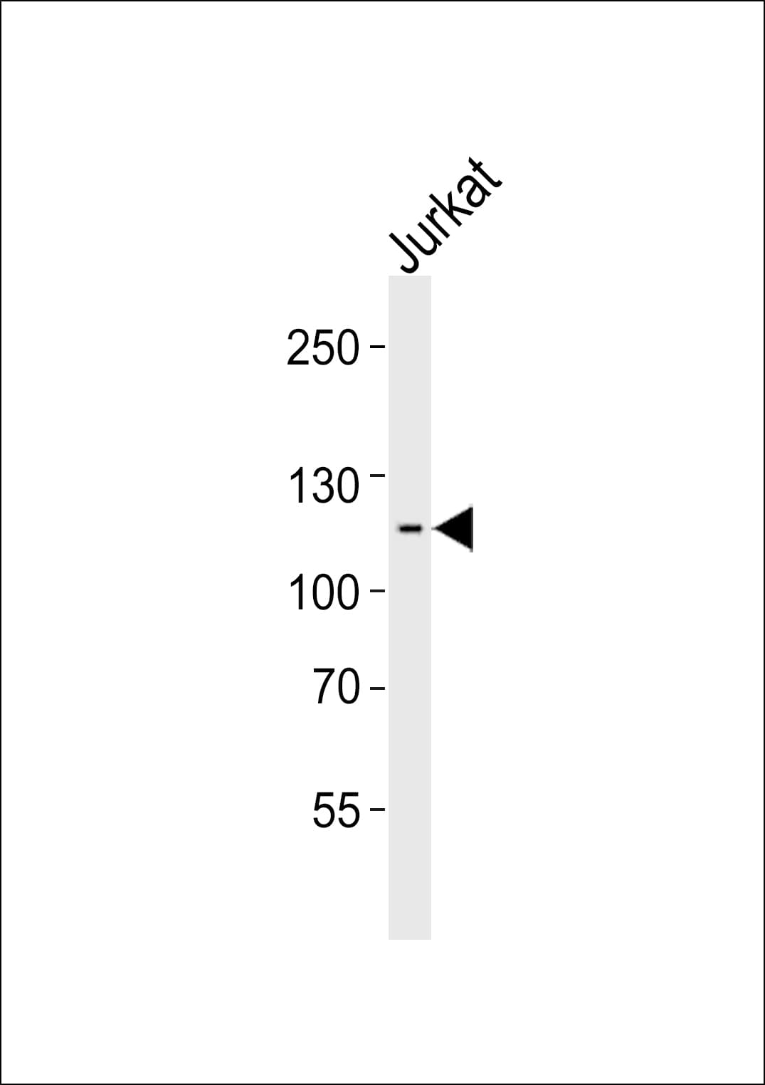 ZNF624 Antibody (aa264-298)