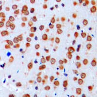 SCN1A / Nav1.1 Antibody (Internal)