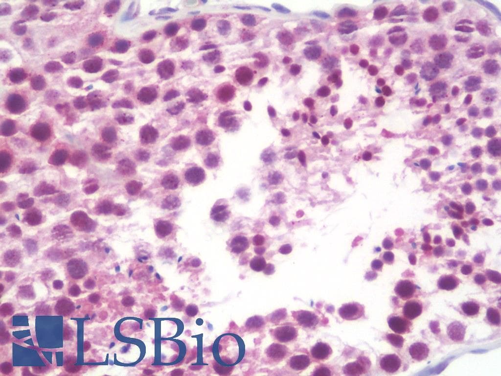 IHC-plus™ OTUB2 Antibody (aa133-182)