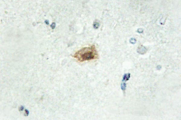 CDK10 Antibody (Glu63)