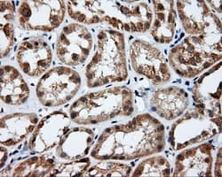 Monoclonal Mouse anti-Human PIM2 / Pim-2 Antibody (clone OTI8B4, IHC, IF, WB)