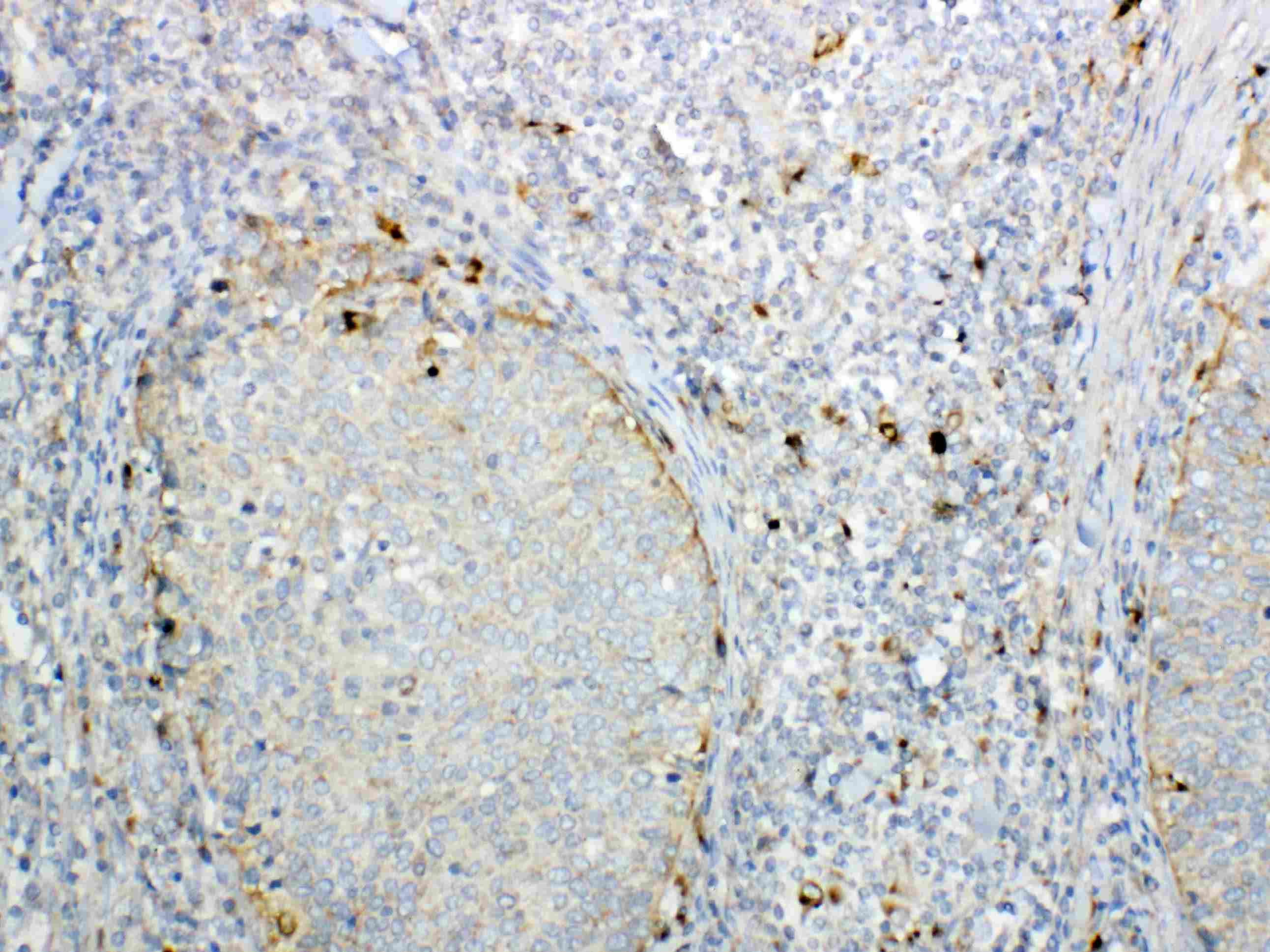 GALNS / Chondroitinase Antibody