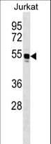 WARS Antibody (aa429-458)
