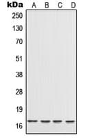 IL17A Antibody (Internal)