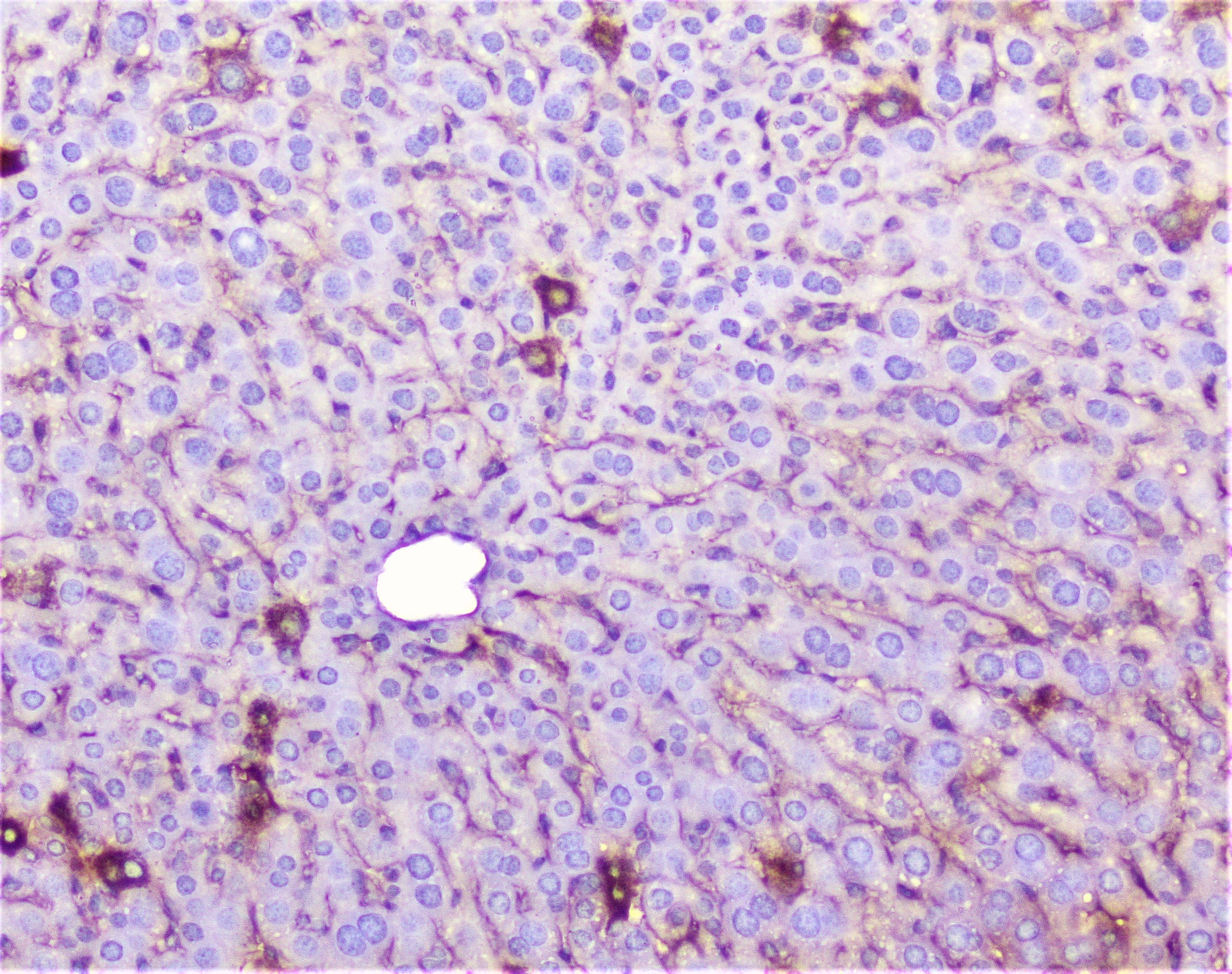 TNFRSF1A / TNFR1 Antibody