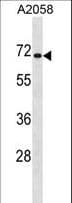 CPEB1 / CPEB Antibody (aa447-475)