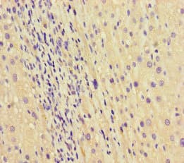 SEPT2 / Septin 2 Antibody