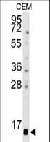 PFDN6 / HKE2 Antibody (aa6-34)