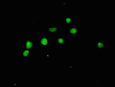 Polyclonal Rabbit anti-Human ACLY / ATP Citrate Lyase Antibody (IHC)