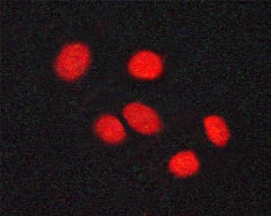 Vitamin D Receptor / VDR Antibody (phospho-Ser208)