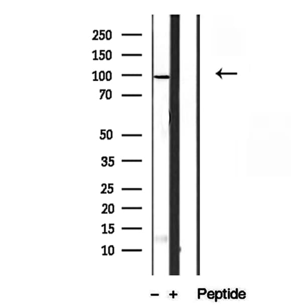 Polyclonal Rabbit anti-Human SECISBP2 / SBP2 Antibody (IHC, WB)