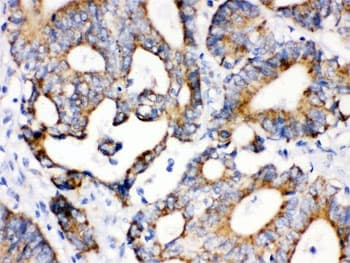 Polyclonal Rabbit anti-Human IDH2 Antibody (IHC, WB)