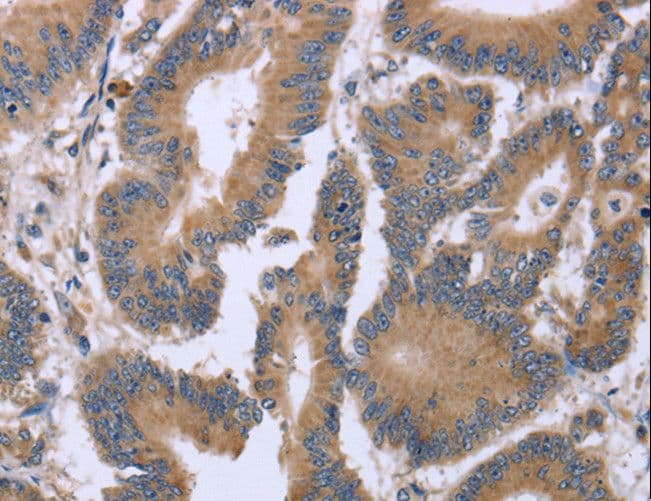 Polyclonal Rabbit anti-Human KIAA1324 / maba1 Antibody (IHC)
