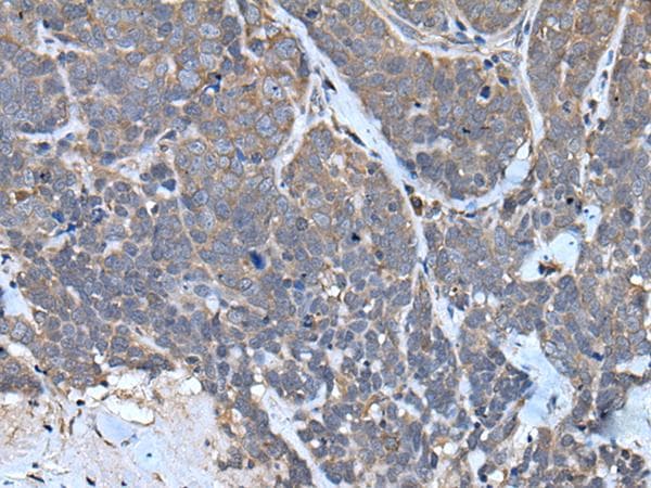 TNMD / Tenomodulin Antibody