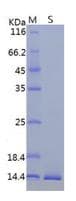 Coronavirus SARS-CoV-2 ORF8 Protein (Recombinant His)