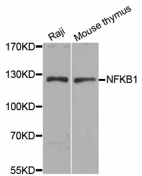NFKB1 / NF-Kappa-B Antibody