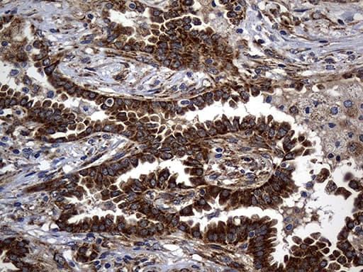 ALDH7A1 Antibody (clone OTI1A9, Carrier-free)