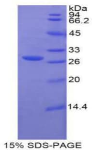 Human GUSB / Beta Glucuronidase Protein (Recombinant His-T7)