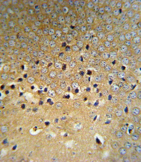 VHL / Von Hippel Lindau Antibody (aa43-71)