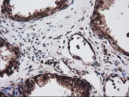 ERGIC-53 / LMAN1 Antibody (clone OTI1E3)