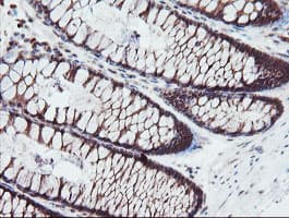 SENP2 Antibody (aa139-523, clone OTI3E7)