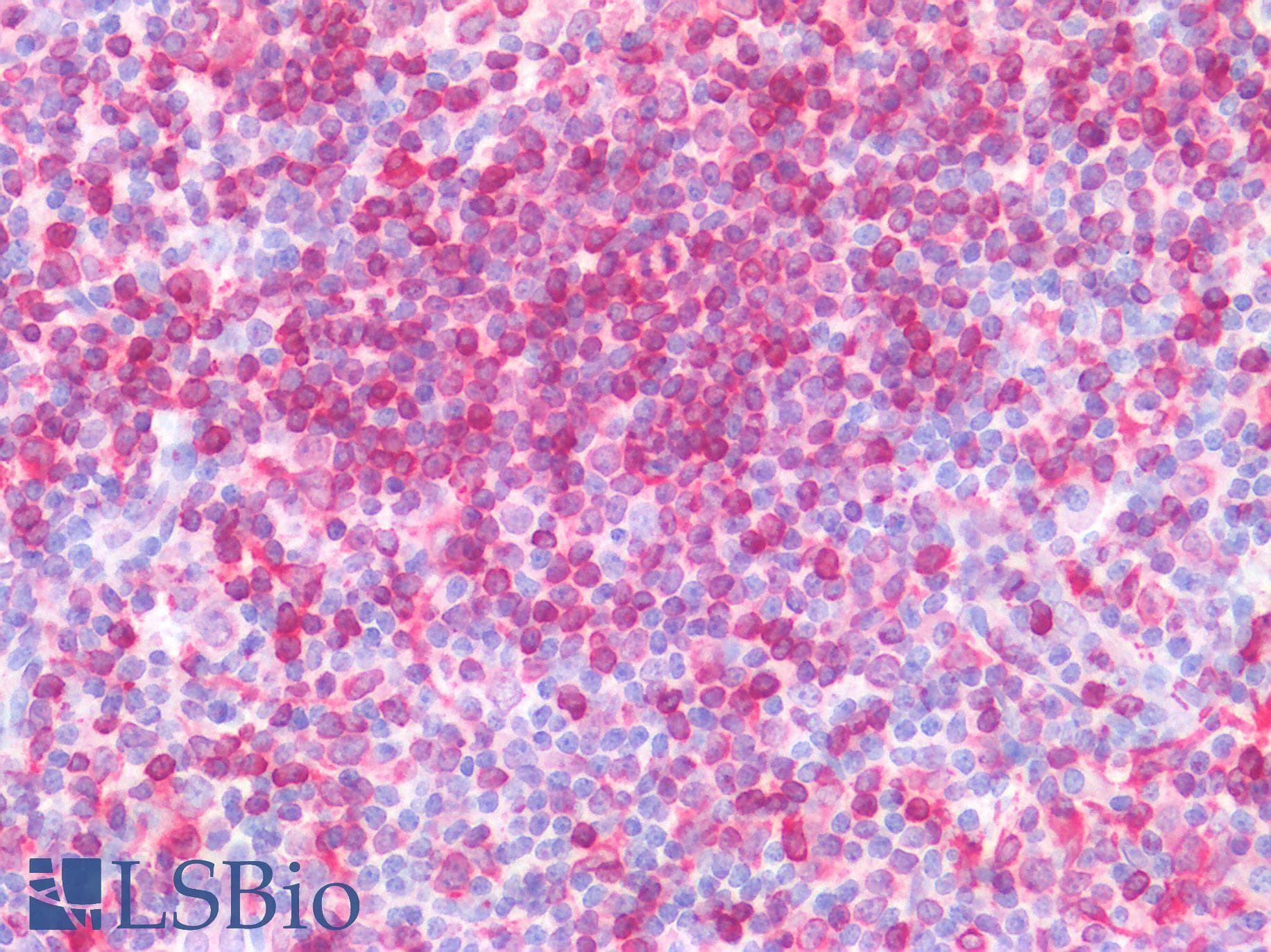 IHC-plus™ CD74 / CLIP Antibody (Internal Region)