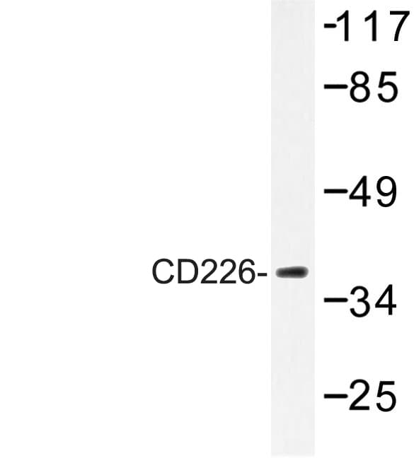 DNAM-1 / CD226 Antibody (Tyr325)