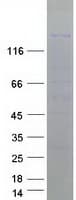 Human ESET / SETDB1 Protein (Recombinant Myc-DDK (Flag))